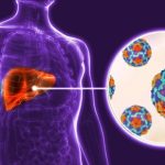 Evolución favorable de casos de hepatitis en Ciego de Ávila