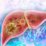 Autoridades sanitarias investigan posible brote de hepatitis en Ciego de Ávila